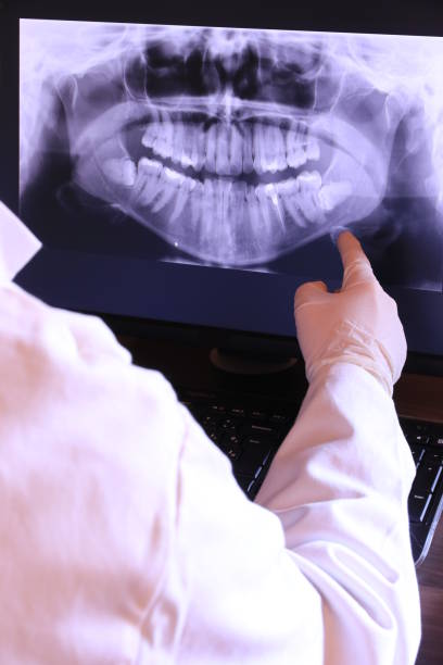 Best Emergency Dentist for Lost Fillings or Crowns in Hudson Falls, NY